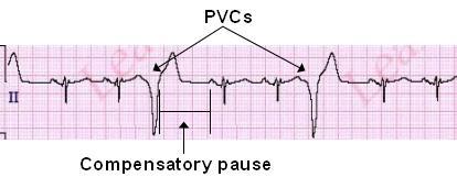 PVCExample