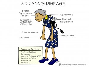 addisons_disease1332524676283