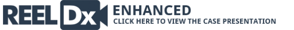 reeldxenhanced2600x63 | The Physician Assistant Life reel dx enhanced2 600x63